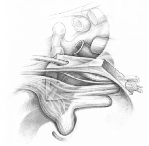 Microsurgical Anatomy Of The Cavernous Sinus - 